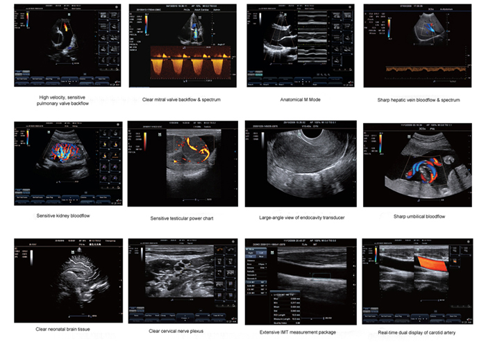 Superb ultrasound images by ES250V digital veterinary color Doppler ultrasound machine